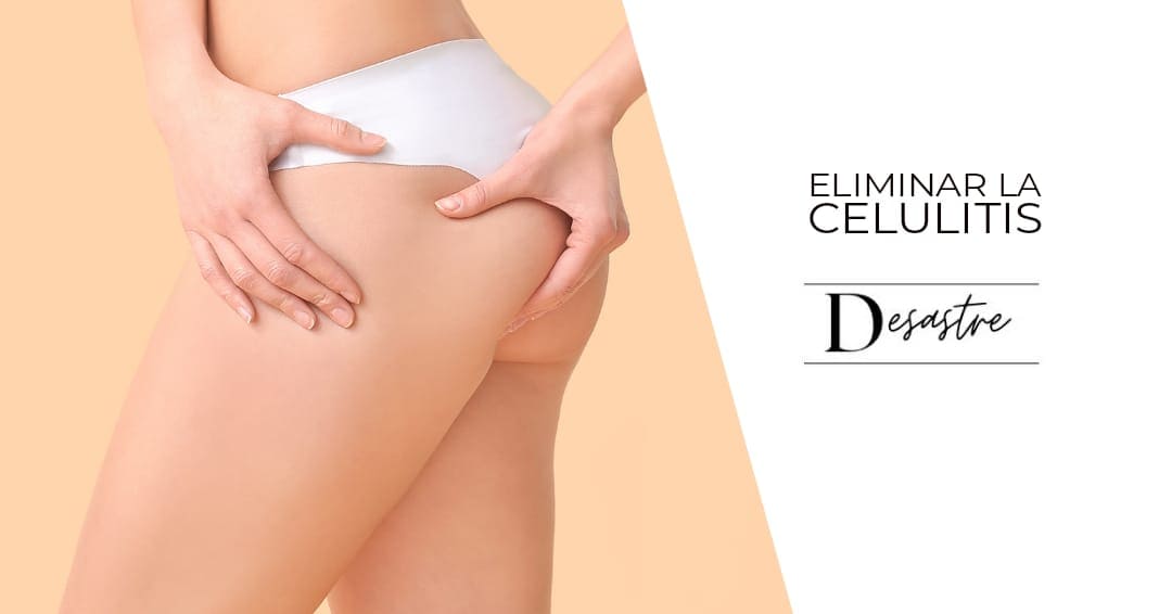 celulitis