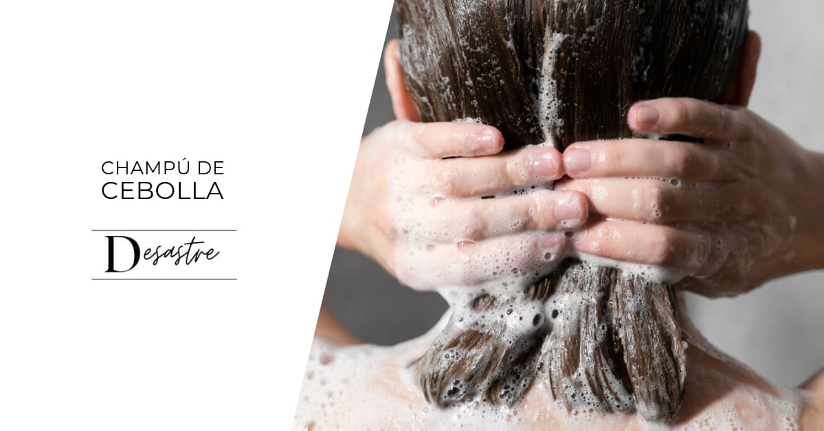 Champú de cebolla